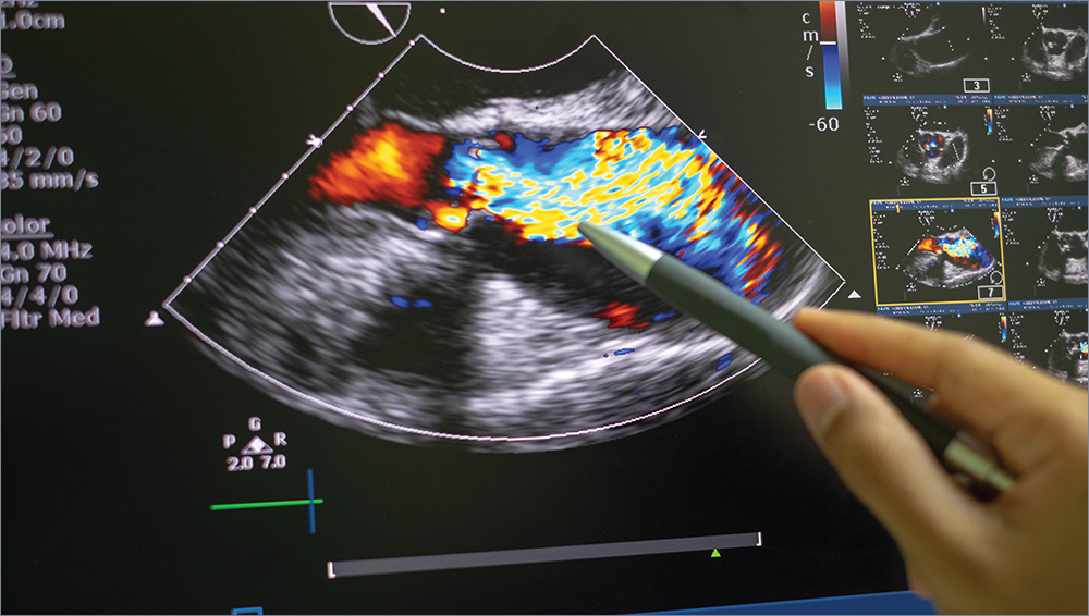 Expanding Access to Sonography Training to Meet Workforce Needs