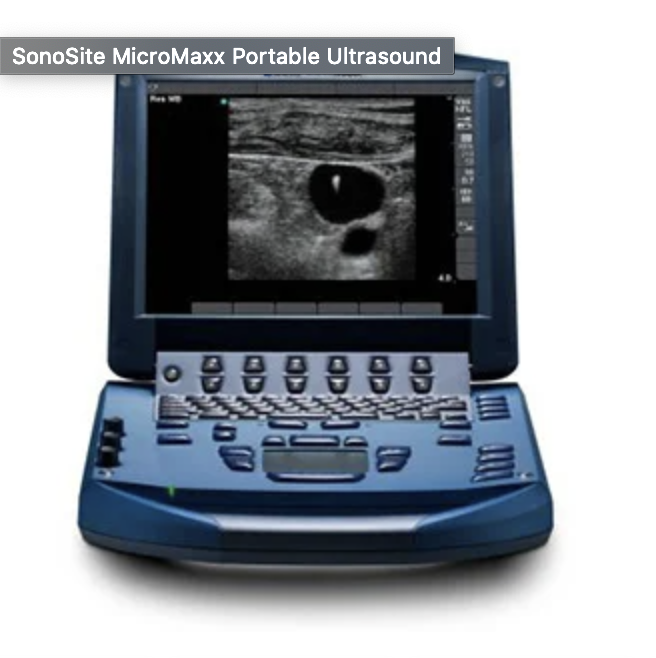 ultra sound machine