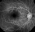 retinal photo