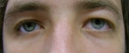 close-up photo of two eyes