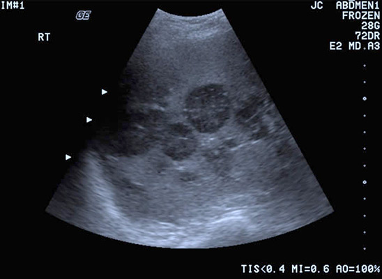 Ultrasound Image