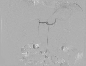 Vascular and Interventional Radiology animated gif