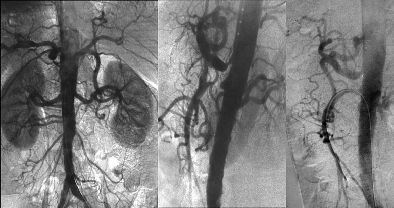 Vascular and Interventional Radiology x-ray group