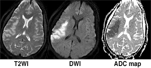 3 brain MRI's